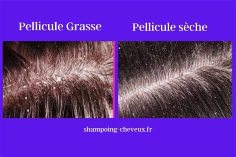 escorte grase|Escort Grasse .